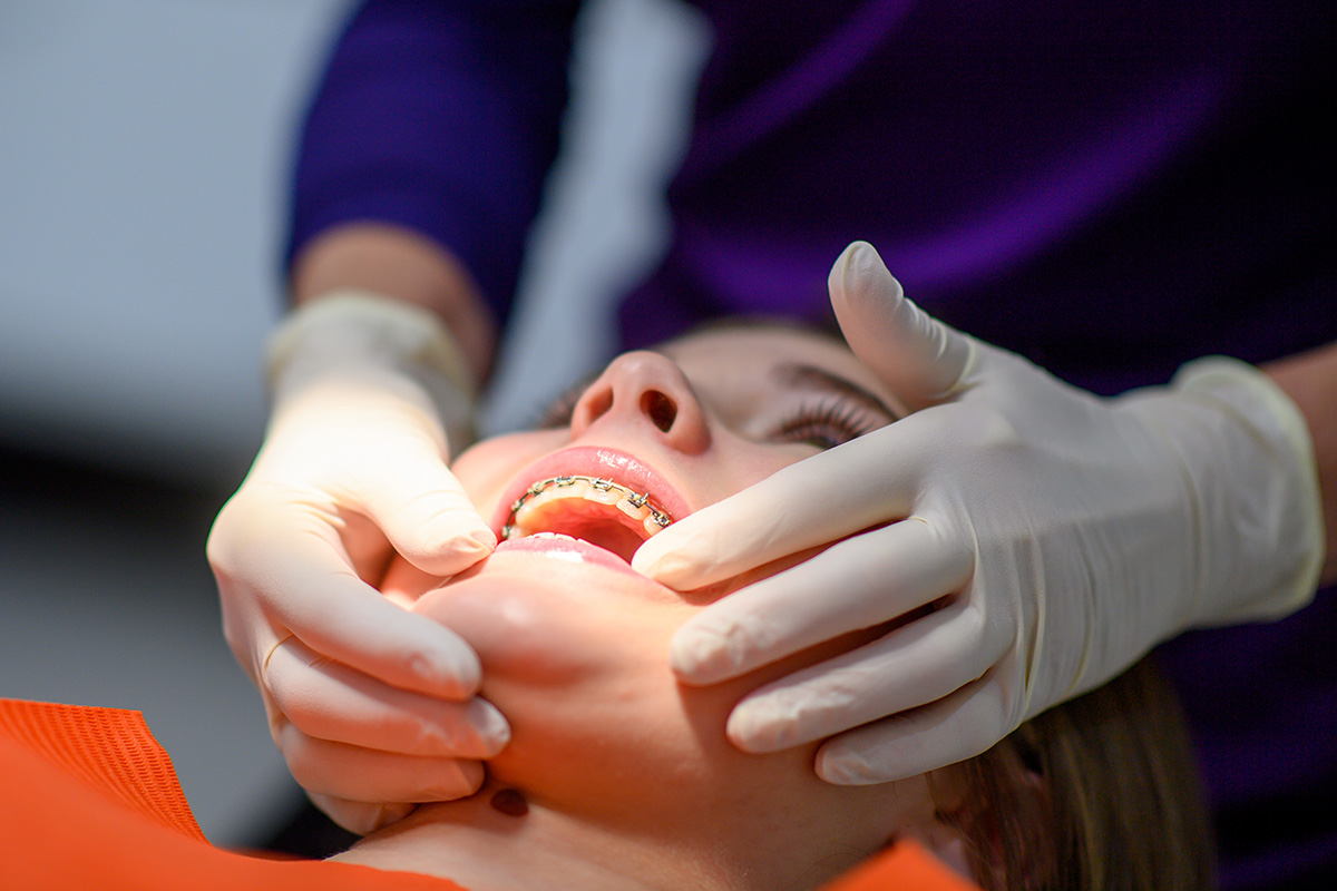appareil multi-attache bague orthodontei dr lietz lyon